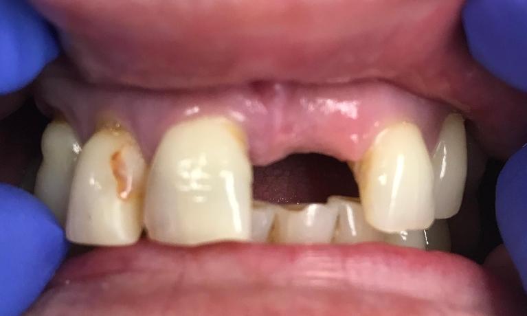 A-brand-new-smile-Before-Image